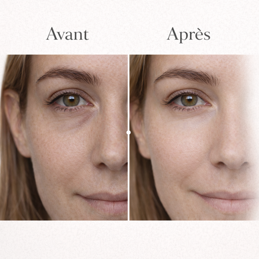 SKYNLUXE™ – Patches Yeux Micro-Aiguilles Coréens